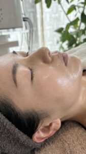 諦めなくてよかった！シミケア3回で起きた「お肌と心の変化」