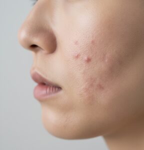 「もう一生、治らないと思っていました」毎日泣いていた彼女が、2ヶ月で笑顔を取り戻した理由