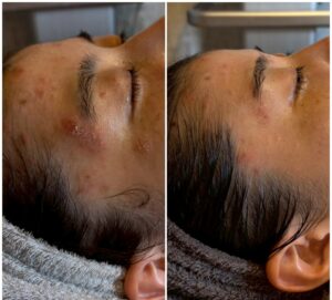 「サロンで来るだけ」では終わらせない。2ヶ月で奇跡を起こした彼女が守り続けた「お約束」